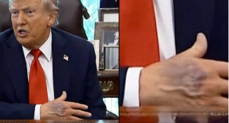 Dora e nxirë e Trump, Shtëpia e Bardhë sqaron gjendjen shëndetësore të presidentit