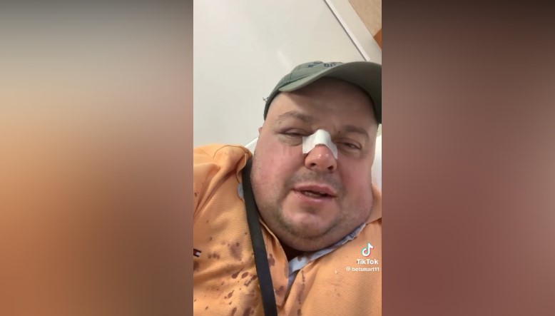 Goditi me grusht Genard Hajdinin dhe babain e tij, nis hetimi për 40-vjeçarin! Shoqërohej me një vajzë të re, ja çfarë ka deklaruar ajo